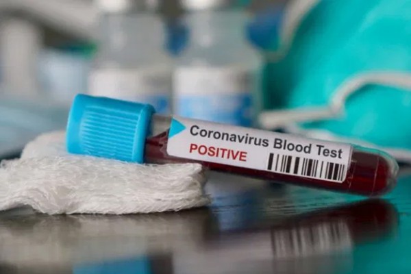 Coronavirus, sono venti i casi a Palma Campania